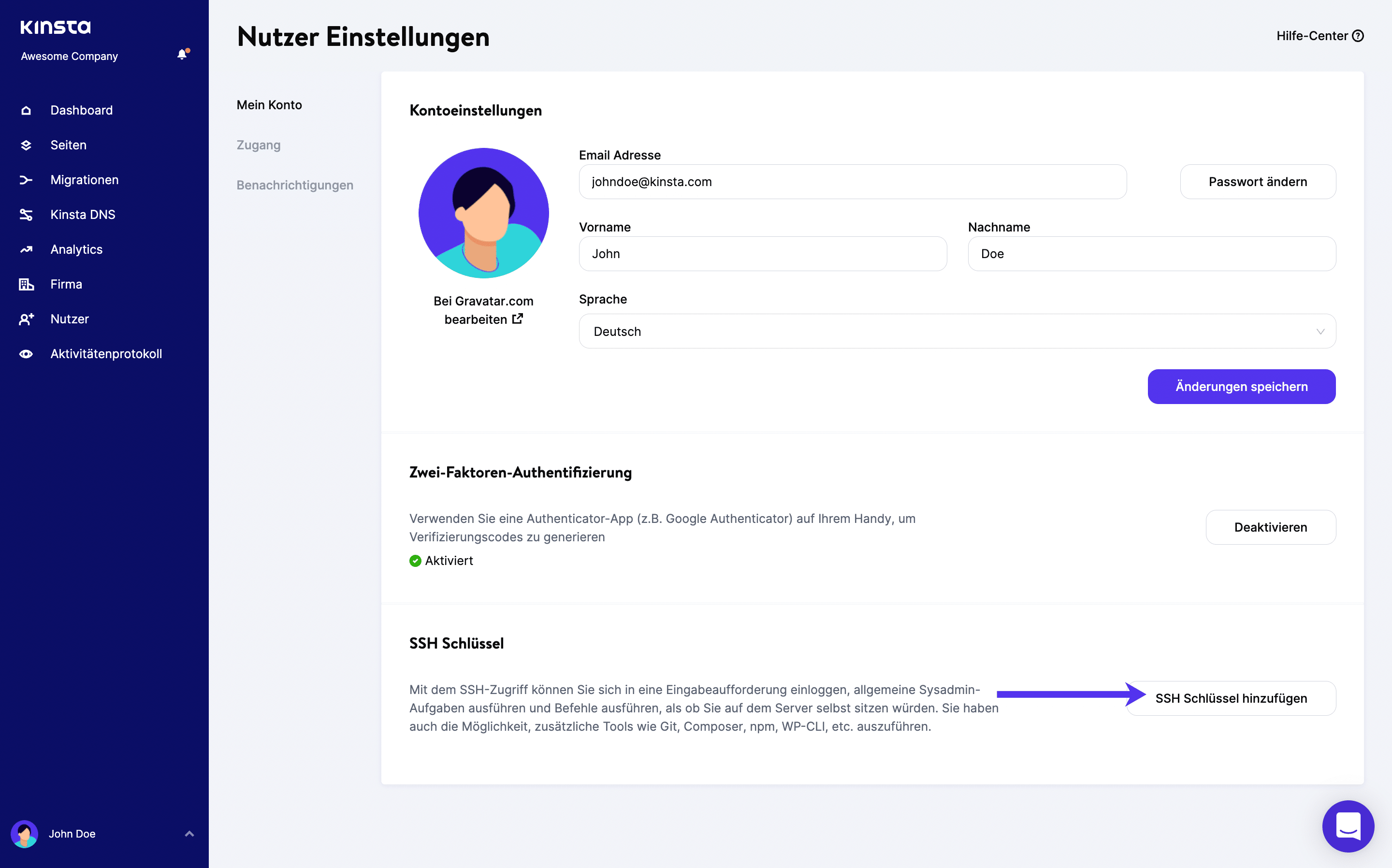 SSH-Schlüssel in MyKinsta hinzufügen.