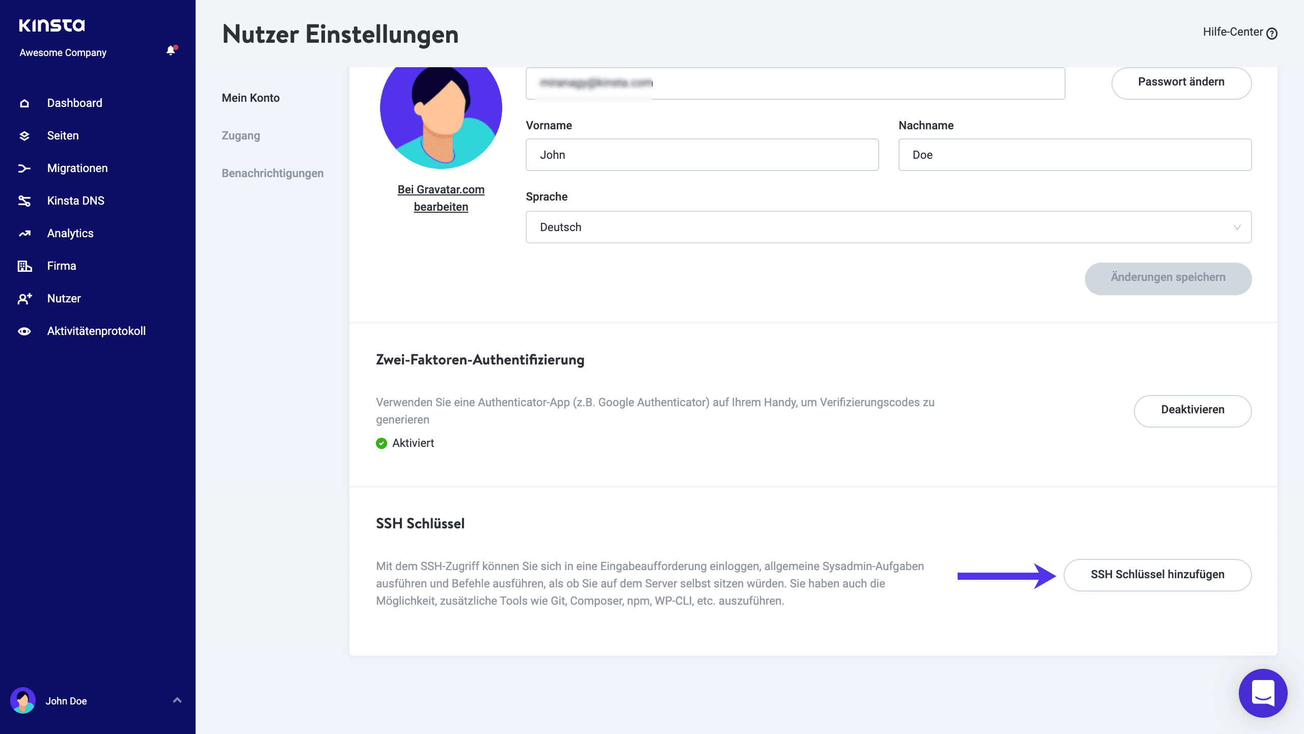 SSH-Schlüssel in MyKinsta hinzufügen.