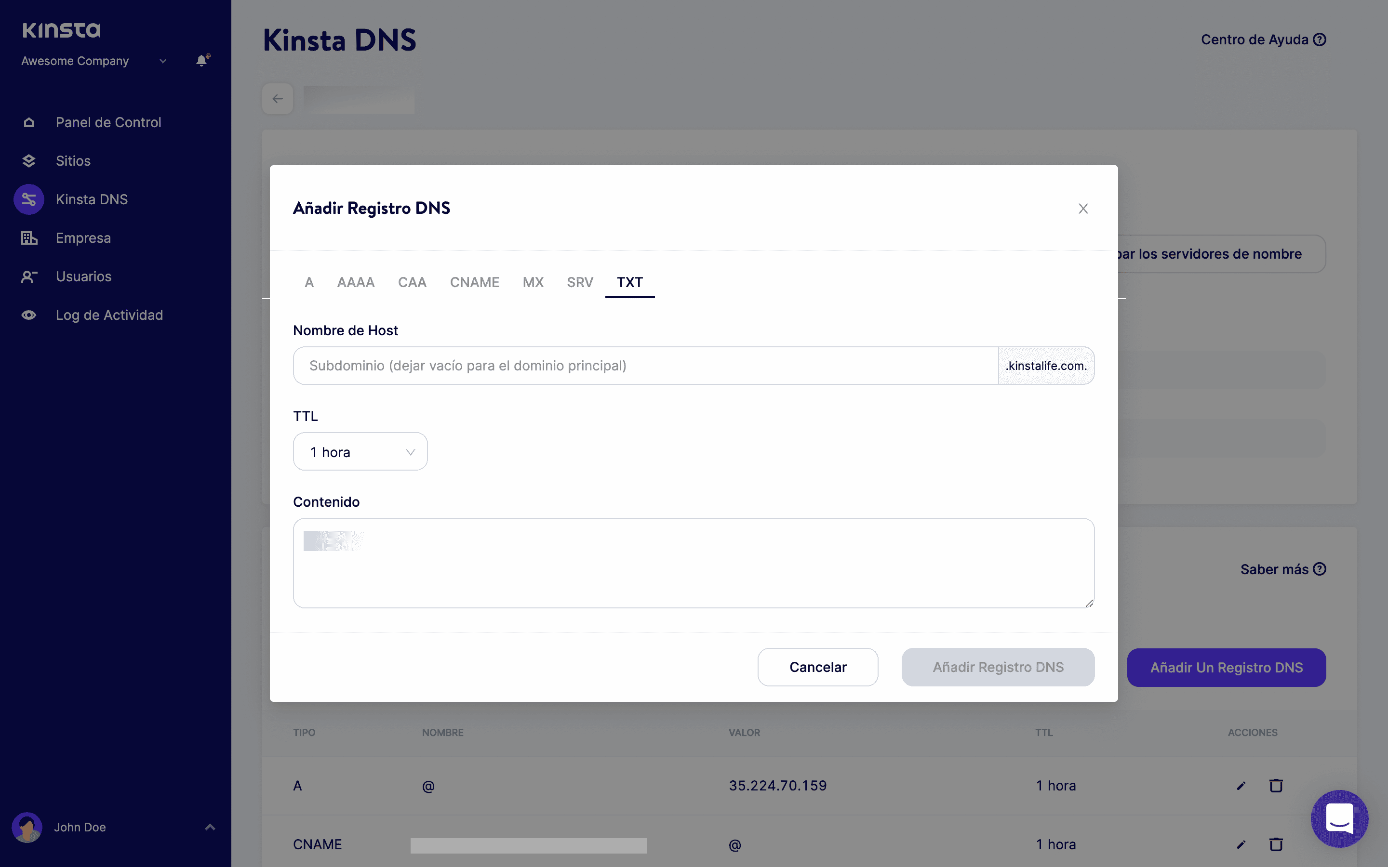 Añadir un registro DNS en MyKinsta
