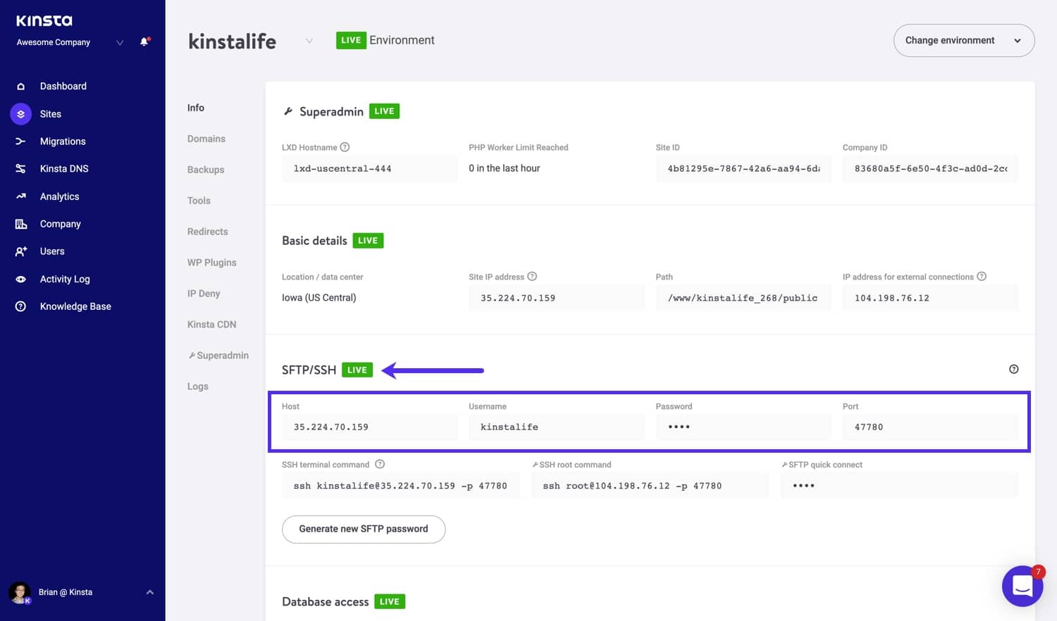 Informations SFTP de Kinsta.